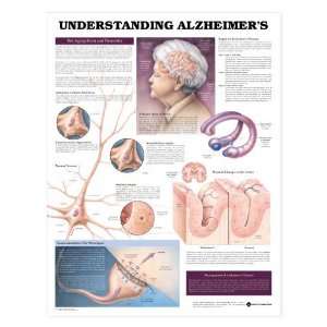 Understanding Alzheimers Disease Chart  Industrial 