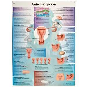   Birth Control Anatomical Chart, Spanish), Poster Size 20 Width x 26