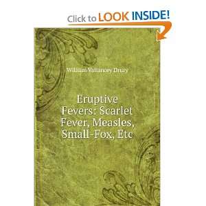  Eruptive Fevers Scarlet Fever, Measles, Small Fox, Etc 